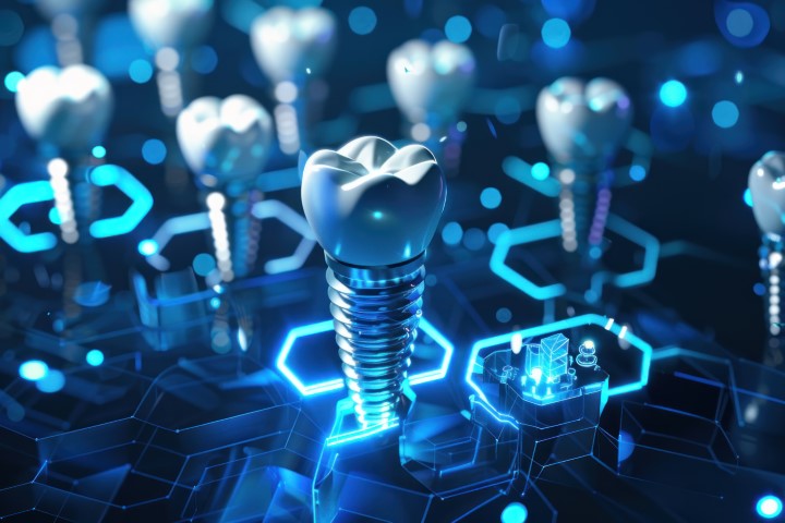 implant3